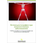 Остеосцинтиграфия при онкологических заболеваниях. Учебное пособие