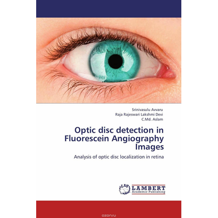 Optic disc detection in Fluorescein Angiography Images