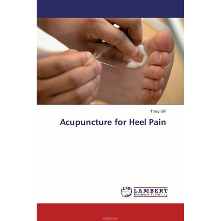 Acupuncture for Heel Pain