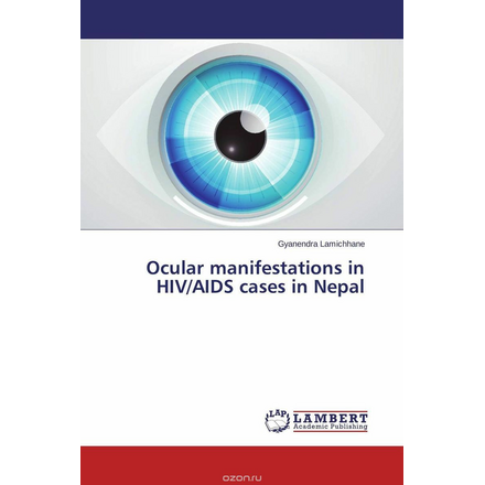 Ocular manifestations in HIV/AIDS cases in Nepal