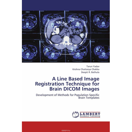 A Line Based Image Registration Technique for Brain DICOM Images