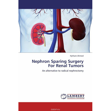 Nephron Sparing Surgery For Renal Tumors