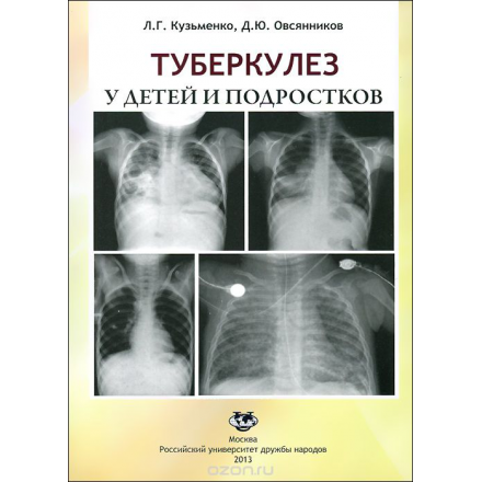 Туберкулез у детей и подростков. Учебное пособие